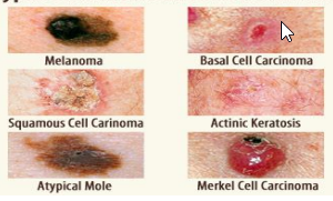 Skin Care/ Skin Cancer - Playford Medical Centre