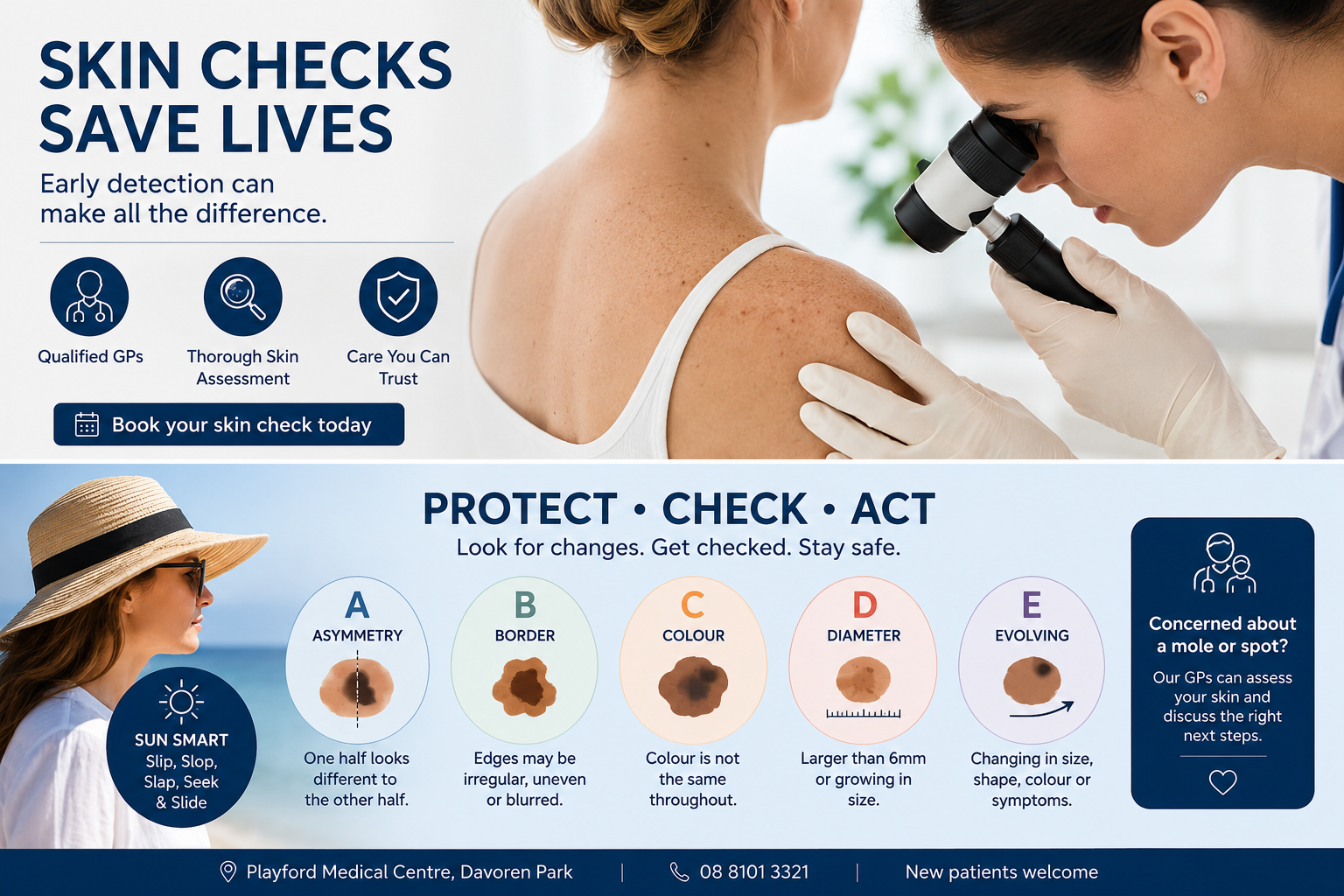 Skin checks mole check skin cancer check